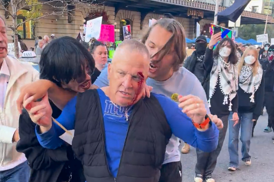 man with blood on face after No Kings protest altercation