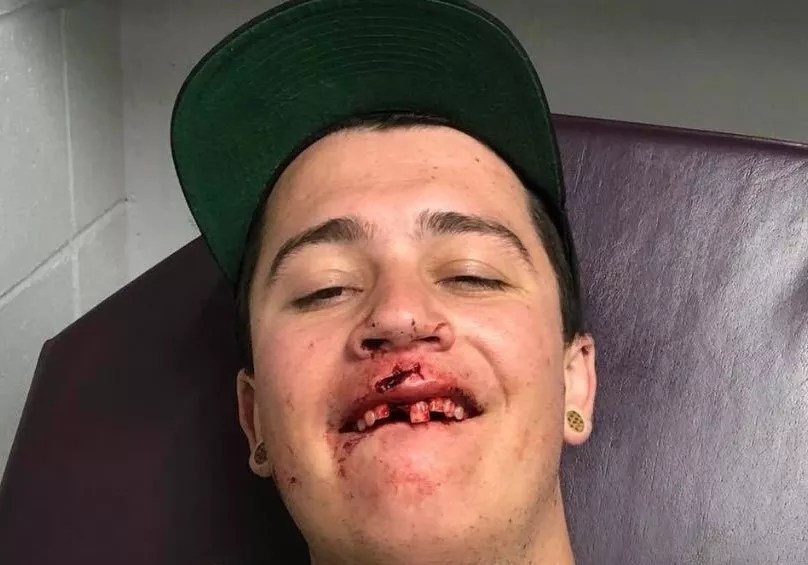 Man Assaulted at Joe Russo’s Almost Dead Red Rocks Concert